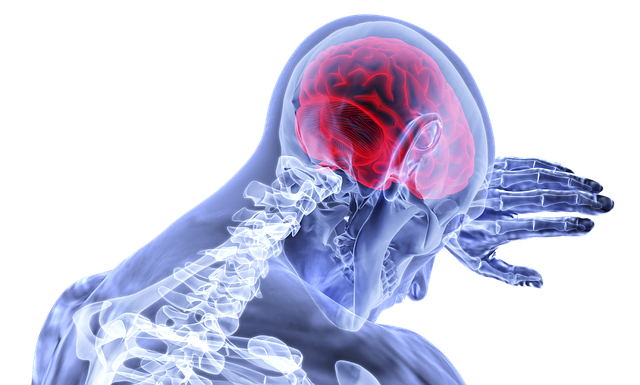 Hjernerystelse behandling: Hvad skal jeg gøre?